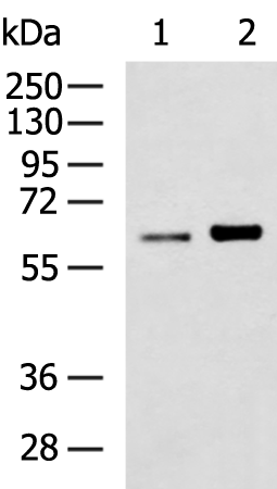 TNFRSF11A