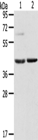 HIF1AN