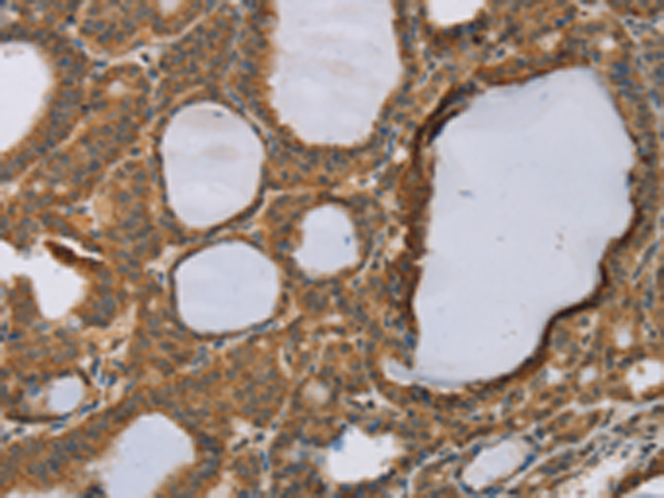 Rabbit Polyclonal Antibody to RNF5