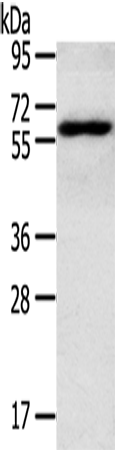 RORA