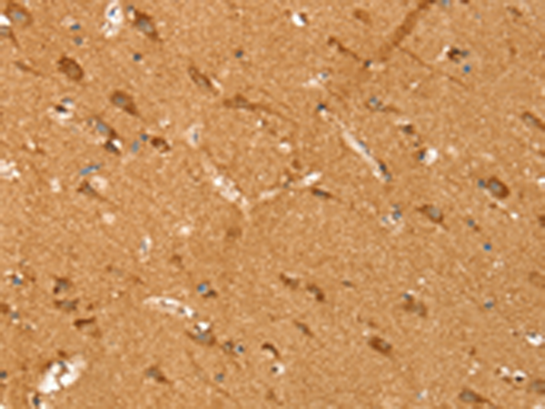Rabbit Polyclonal Antibody to SIRT4