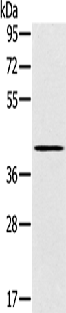 SLC14A1