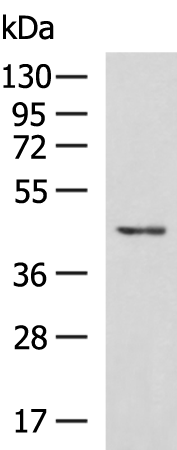 SLC16A11