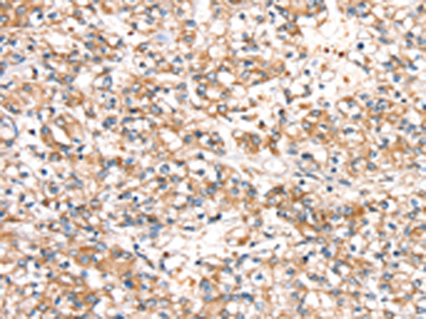 SLC24A3