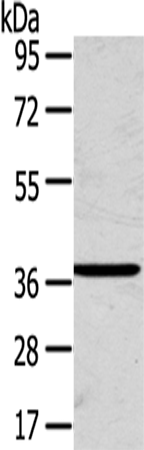 SLC25A20