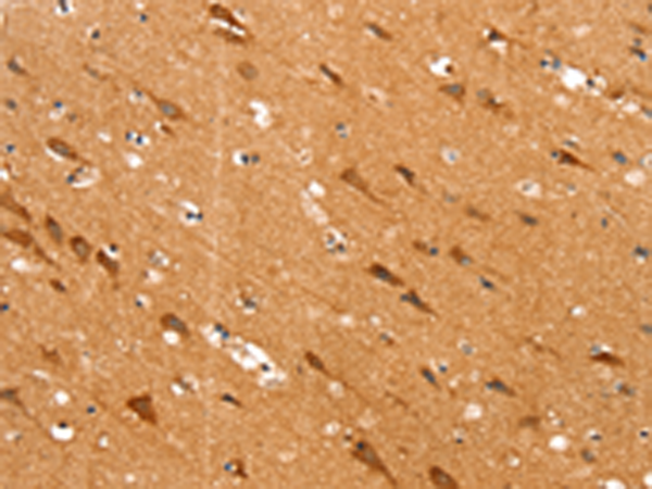 SLC25A12