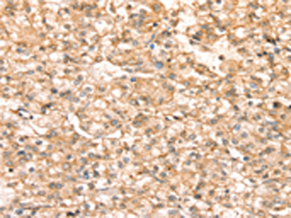 SLC25A38