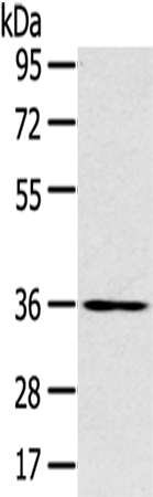 SLC39A9