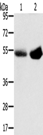 SLC13A3