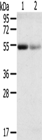 SLC17A1