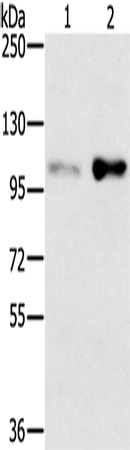 SLTM