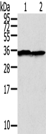 STX3