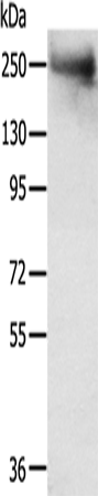 TACC2