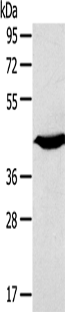KCNK3