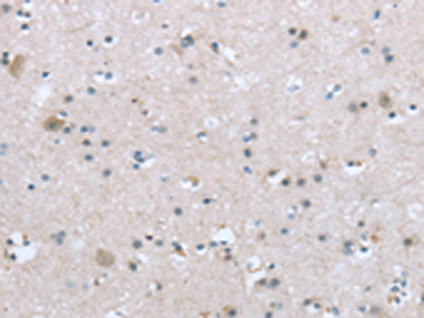 TRPM3