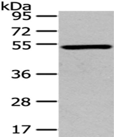 TSPYL1