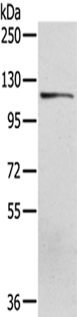 UBA1