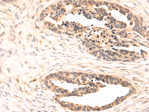 Rabbit Polyclonal Antibody to CHD3