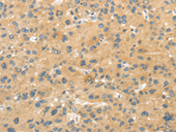 MPP6
