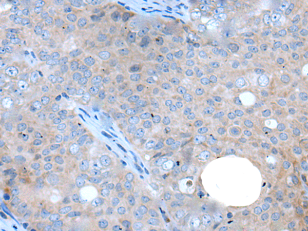 Rabbit Polyclonal Antibody to WAPL