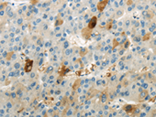 Rabbit Polyclonal Antibody to WNK1