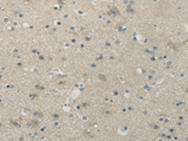 Rabbit Polyclonal Antibody to WNK1