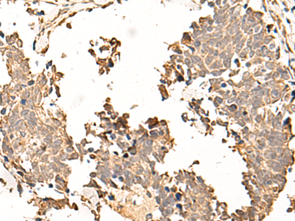 Rabbit Polyclonal Antibody to SOX3