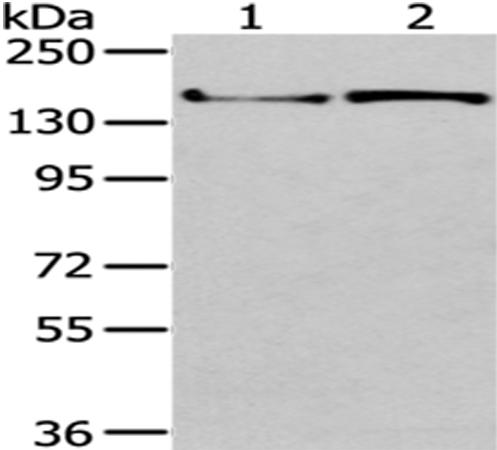 WNK3 