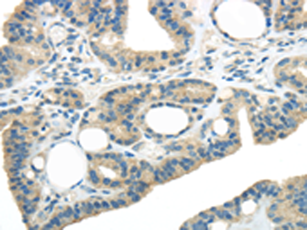 Rabbit Polyclonal Antibody to WNK3 