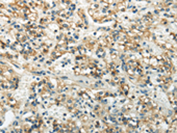 Rabbit Polyclonal Antibody to WNK3 