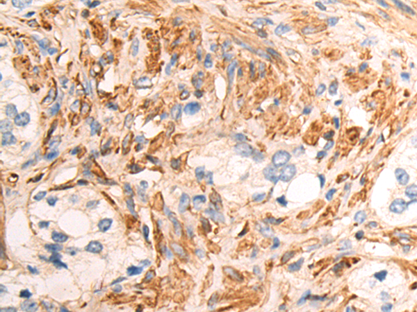 Rabbit Polyclonal Antibody to WNT2