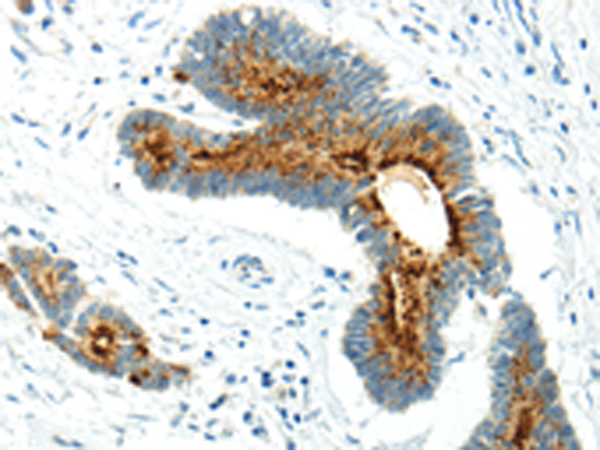 Rabbit Polyclonal Antibody to WWOX