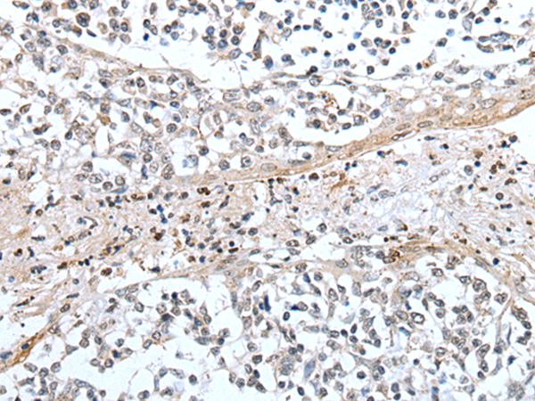 Rabbit Polyclonal Antibody to XAF1
