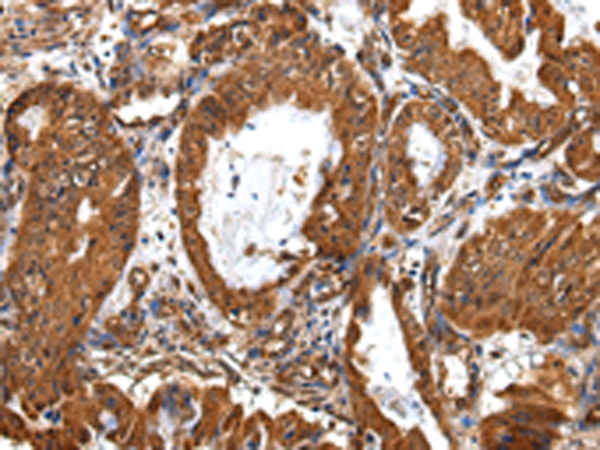 Rabbit Polyclonal Antibody to ZBTB2