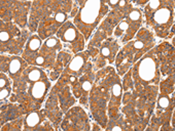 ZNF281