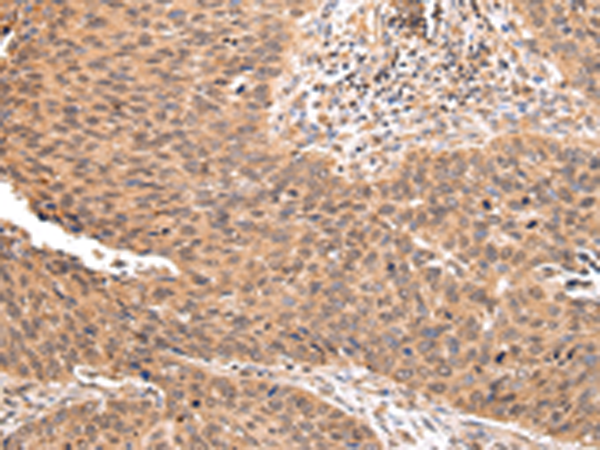 ZNF146