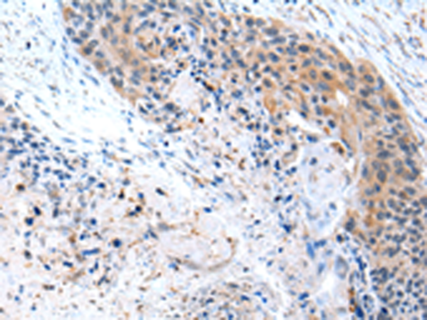 Rabbit Polyclonal Antibody to CFC1
