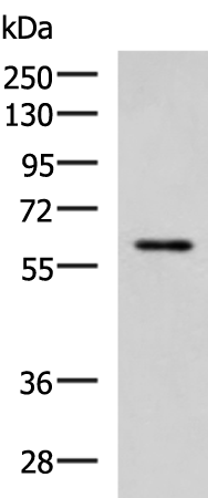 ECM1