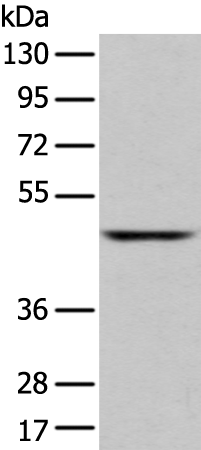 SLC2A6