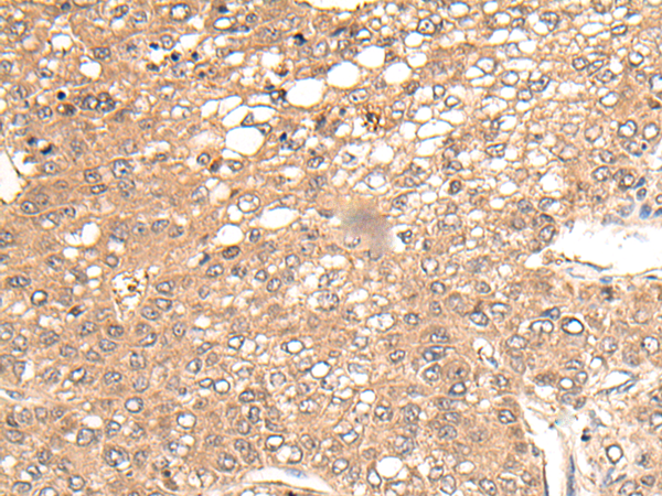 CHRNA6