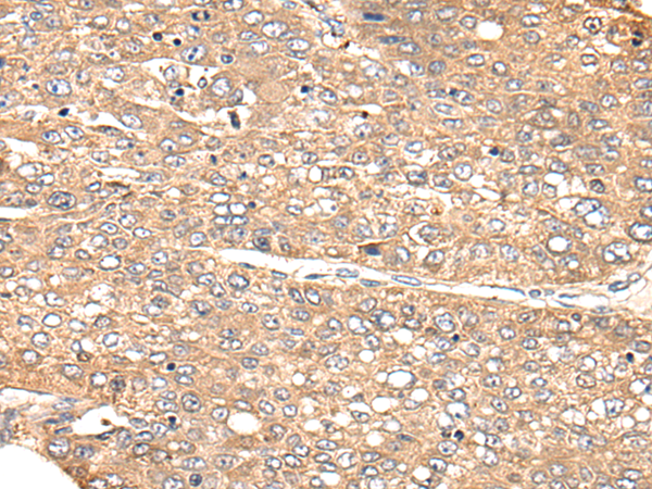 CHRNA9