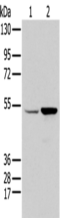 EGR2