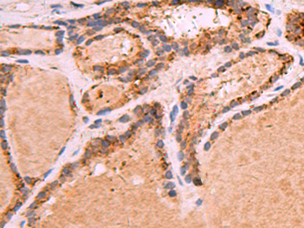 GPC2