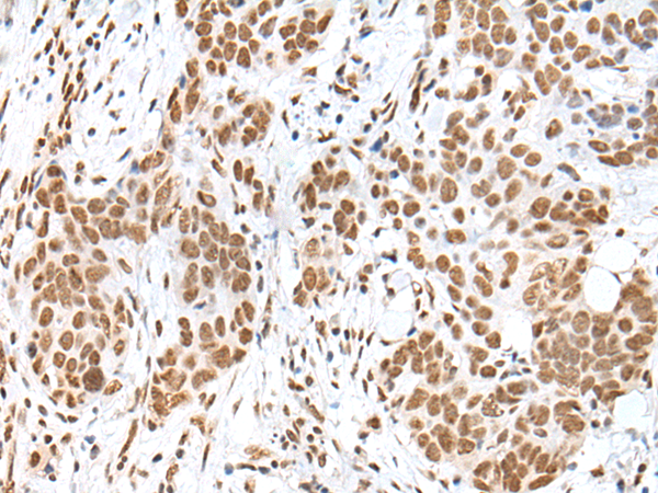 HCN3