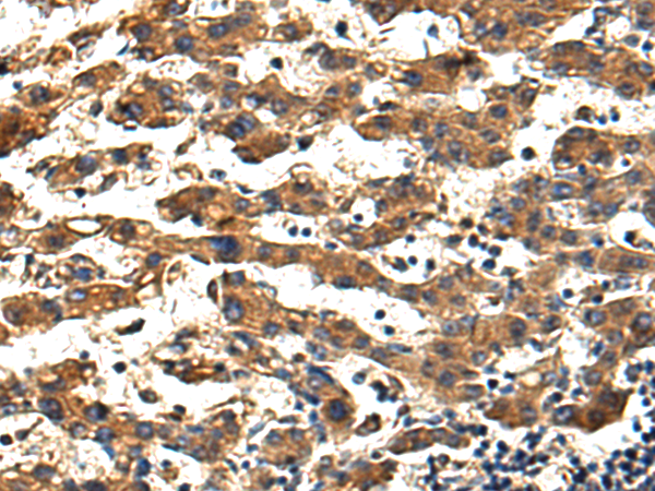 HDAC4