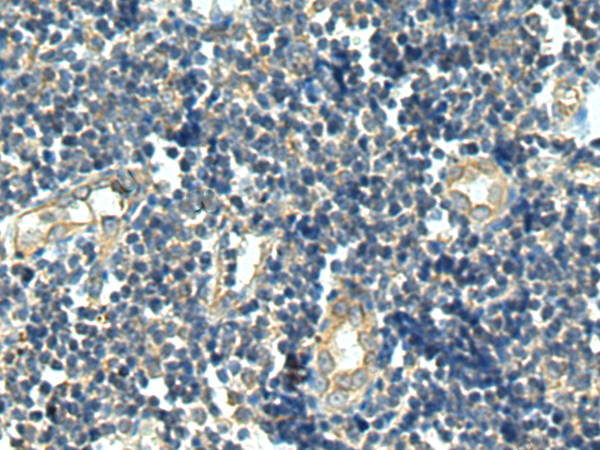 PRH2
