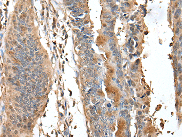 HSP90AB1