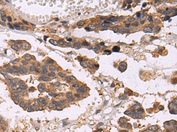 CXCL10