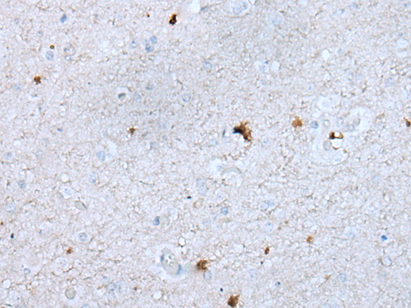 GAS2L1