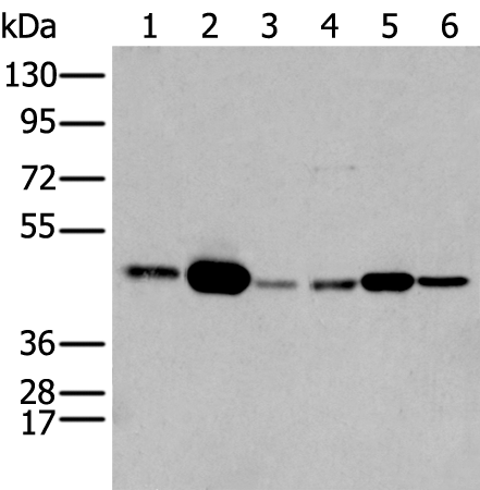 SERPINH1